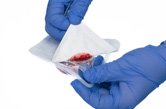 Removing Tyvek backing while securing gauze