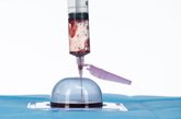 Injecting blood into the coagulation mold