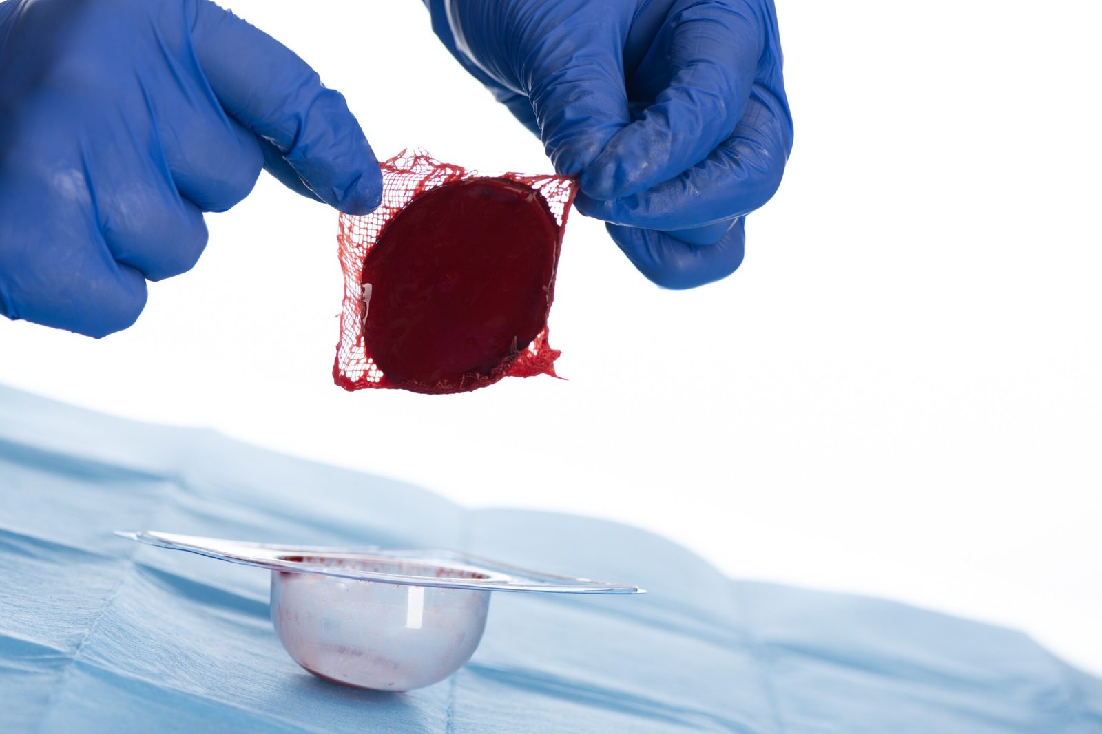 Microscopic view of ActiGraft wound healing biology